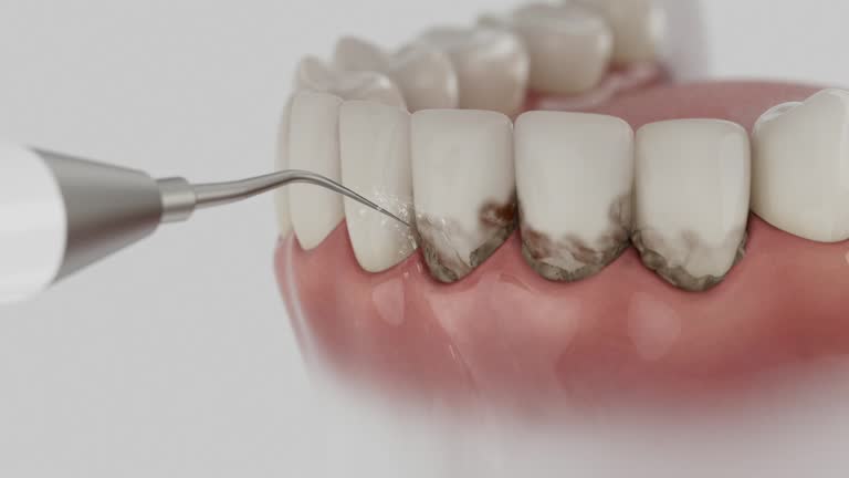 Trusted Dental Implants service in Hawkinsville, GA - Dentist Open Now